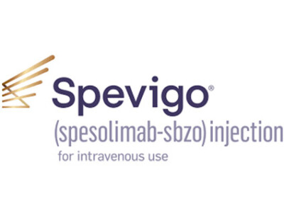 Spevigo® (spesolimab-sbzo)
